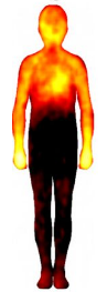 représentation du corps avec les zones de chaleur liées à la colère